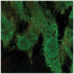 GRK5 Antibody, Novus Biologicals 100&mu;L; Unlabeled:Antibodies, Polyclonal