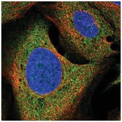 Growth Hormone R Antibody, Novus Biologicals 25 &mu;L:Antibodies, Polyclonal