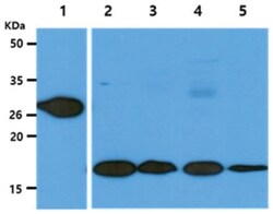GSTT1 Mouse anti-Human, Clone: 38D11, Novus Biologicals 100&mu;L; Unlabeled:Antibodies,