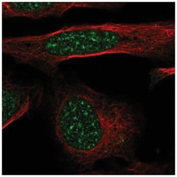 GTF2H4 Antibody, Novus Biologicals:Antibodies:Primary Antibodies