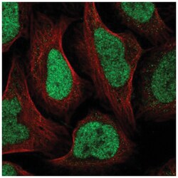 GTF2IRD2B Antibody, Novus Biologicals 100&mu;L; Unlabeled:Antibodies, Polyclonal