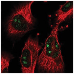 GTPBP4 Antibody, Novus Biologicals 25 &mu;L, Unlabeled:Antibodies, Polyclonal
