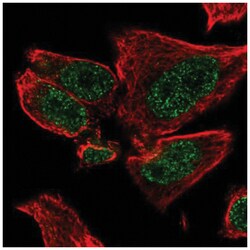 Hairless Rabbit anti-Human, Polyclonal, Novus Biologicals 100&mu;L; Unlabeled:Antibodies,