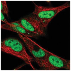 HAND2 Antibody, Novus Biologicals 100&mu;L; Unlabeled:Antibodies, Polyclonal