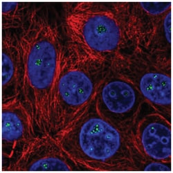HDAC10 Antibody, Novus Biologicals:Antibodies:Primary Antibodies
