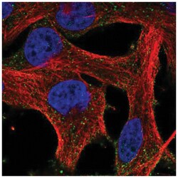 HEBP1 Antibody, Novus Biologicals 100 &mu;L | Buy Online | Novus Biologicals | Fisher Scientific