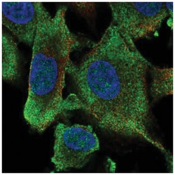 HECW1 Antibody, Novus Biologicals 100&mu;L; Unlabeled:Antibodies, Polyclonal