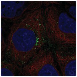 HEG1 Antibody, Novus Biologicals 100μL; Unlabeled:Antibodies, Polyclonal