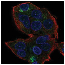 HEPN1 Antibody, Novus Biologicals 25 &mu;L:Antibodies, Polyclonal
