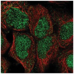 HIC2 Antibody, Novus Biologicals 25 &mu;L; Unconjugated:Antibodies, Polyclonal