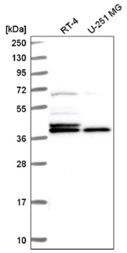 Histone H2AY/macroH2A.1 Antibody, Novus Biologicals 100&mu;L; Unlabeled:Antibodies,