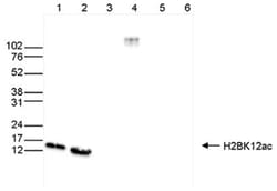 Histone H2B, ac Lys12 Antibody, Novus Biologicals 50&mu;g; Unlabeled:Antibodies,