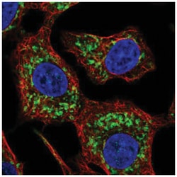 HKDC1 Antibody, Novus Biologicals 100&mu;L; Unlabeled:Antibodies, Polyclonal