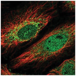 HKR1 Antibody, Novus Biologicals 100&mu;L; Unlabeled:Antibodies, Polyclonal