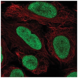 NHC Antibody, Novus Biologicals:Antibodies:Primary Antibodies