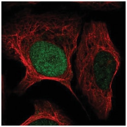 HMX3 Antibody, Novus Biologicals 100 &mu;L | Buy Online | Novus Biologicals | Fisher Scientific