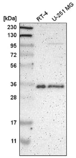 hnRNP A1 Antibody, Novus Biologicals 100&mu;L; Unlabeled:Antibodies, Polyclonal