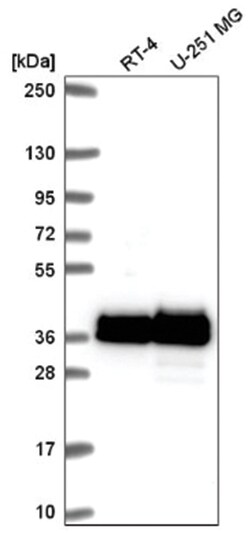 hnRNP A2B1 Antibody, Novus Biologicals 25 &mu;L, Unlabeled:Antibodies,