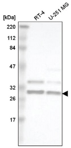 hnRNP A2B1 Antibody, Novus Biologicals 100&mu;L; Unlabeled:Antibodies,