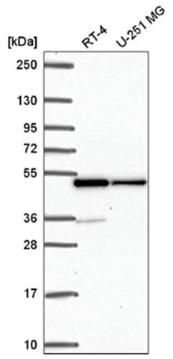 hnRNP F Antibody, Novus Biologicals 100&mu;L; Unlabeled:Antibodies, Polyclonal