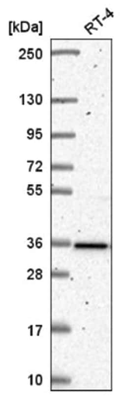 HNRNPA0 Antibody, Novus Biologicals 100&mu;L; Unlabeled:Antibodies, Polyclonal