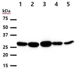 HO-1/HMOX1/HSP32 Mouse anti-Human, Clone: 1D6, Novus Biologicals:Antibodies:Primary