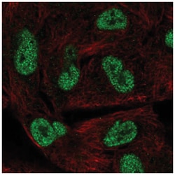 HORMAD1 Antibody, Novus Biologicals 25 &mu;L:Antibodies, Polyclonal