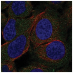 Hormone-sensitive Lipase/HSL Antibody, Novus Biologicals:Antibodies:Primary