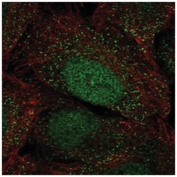 HOXA2 Antibody, Novus Biologicals:Antibodies:Primary Antibodies