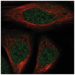 HOXA7 Antibody, Novus Biologicals 25 &mu;L:Antibodies, Polyclonal