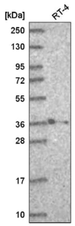 HOXB2 Antibody, Novus Biologicals 100 &mu;L | Buy Online | Novus Biologicals | Fisher Scientific