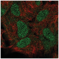 HOXB5 Antibody, Novus Biologicals 100&mu;L; Unlabeled:Antibodies, Polyclonal