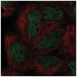 HOXB8 Antibody, Novus Biologicals:Antibodies:Primary Antibodies