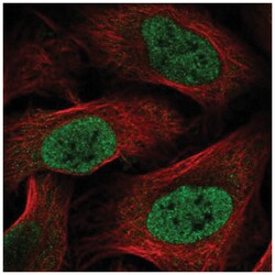 HOXC6 Antibody, Novus Biologicals 100&mu;L; Unlabeled:Antibodies, Polyclonal