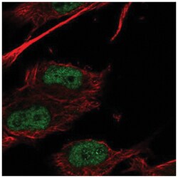 HOXC9 Antibody, Novus Biologicals 25 &mu;L, Unlabeled:Antibodies, Polyclonal