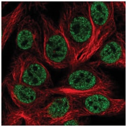 HOXD1 Antibody, Novus Biologicals 100 &mu;L | Buy Online | Novus Biologicals | Fisher Scientific