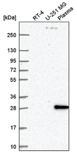HOXD1 Antibody, Novus Biologicals 100 &mu;L | Buy Online | Novus Biologicals | Fisher Scientific