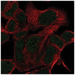 HOXD11 Antibody, Novus Biologicals:Antibodies:Primary Antibodies