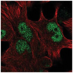 HOXD13 Antibody, Novus Biologicals 100&mu;L; Unlabeled:Antibodies, Polyclonal