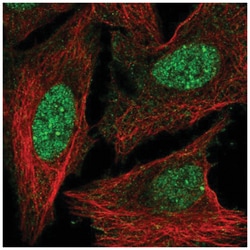 HOXD3 Antibody, Novus Biologicals 25 &mu;L, Unlabeled:Antibodies, Polyclonal