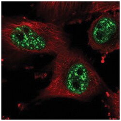 HP1BP3 Antibody, Novus Biologicals 100&mu;L; Unlabeled:Antibodies, Polyclonal