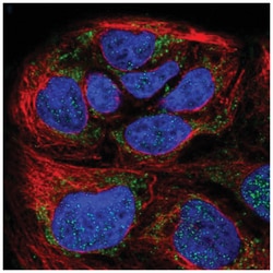 HPDL Antibody, Novus Biologicals 25 &mu;L | Buy Online | Novus Biologicals | Fisher Scientific