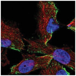 HPS3 Antibody, Novus Biologicals 25 &mu;L, Unlabeled:Antibodies, Polyclonal
