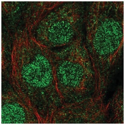 HR6A/UBE2A Antibody, Novus Biologicals 25 &mu;L, Unlabeled:Antibodies,