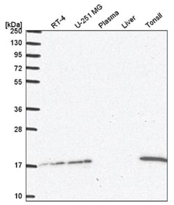 HR6A/UBE2A Antibody, Novus Biologicals:Antibodies:Primary Antibodies