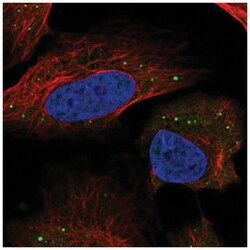 HSD11B1L Antibody, Novus Biologicals 25 &mu;L:Antibodies, Polyclonal