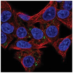 HSD3B7 Antibody, Novus Biologicals 25 &mu;L, Unlabeled:Antibodies, Polyclonal