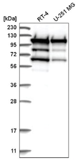 HSPH1/HSP105 Antibody, Novus Biologicals 100&mu;L; Unlabeled:Antibodies,