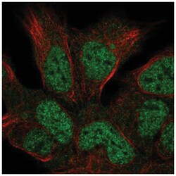 HUS1B Antibody, Novus Biologicals 100&mu;L; Unlabeled:Antibodies, Polyclonal