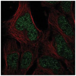 HUS1B Antibody, Novus Biologicals 25 &mu;L, Unlabeled:Antibodies, Polyclonal